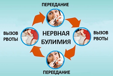 Лечение булимии в Дубовском